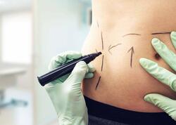 Sevgilisinin &quot;dar gün&quot; üçün yığdığı 140 min dollarını gizlicə estetik əməliyyatlara xərclədi