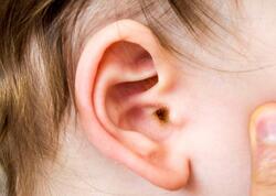 Uşaqlarınızda bu əlamətlər varsa, həkimə aparın - Yoxsa kar qala bilər