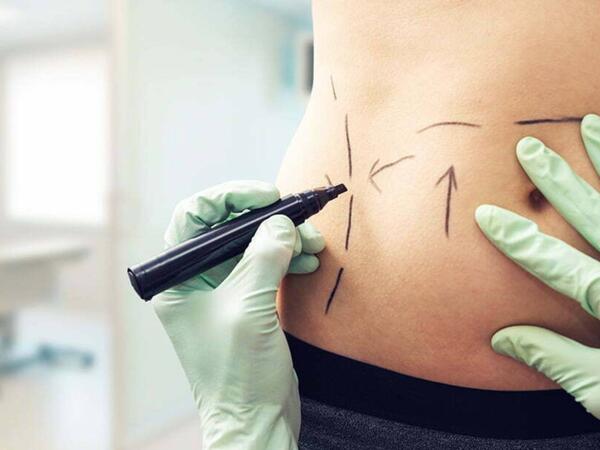 Sevgilisinin &quot;dar gün&quot; üçün yığdığı 140 min dollarını gizlicə estetik əməliyyatlara xərclədi