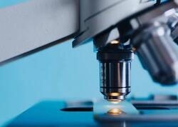 Bu xəstəlik dünyada sadəcə 13 nəfərdə var