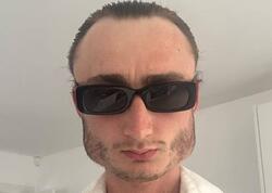 Boksdan üzü bu hala düşdü - FOTO