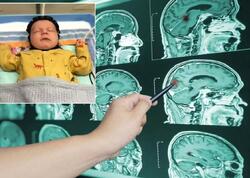 Elmdə inqilab - Möcüzəvi başlıq ixtira olundu