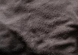 Tiftikləri asanlıqla təmizləyən üsul - yeni kimi görünəcək