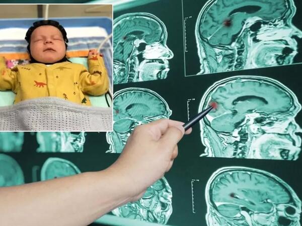 Elmdə inqilab - Möcüzəvi başlıq ixtira olundu