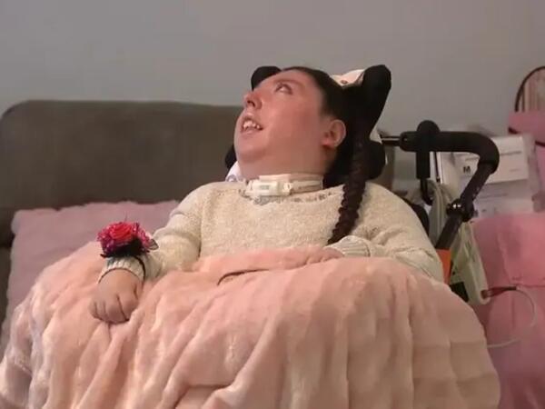 20 il beyinsiz yaşadı