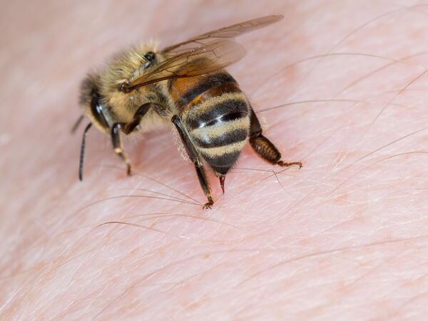 66 yaşlı kişi arı sancmasından öldü