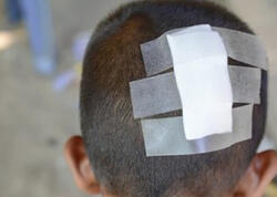 Hesaba görə kafe sahibi ilə mübahisə etdi, 6 yaşlı oğlu başından zərbə aldı