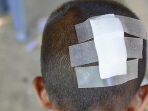 Hesaba görə kafe sahibi ilə mübahisə etdi, 6 yaşlı oğlu başından zərbə aldı