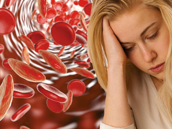 Anemiya yarada biləcək xəstəlik açıqlanıb