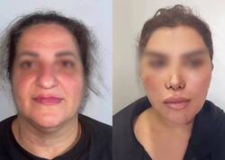 60 yaşlı qadını əməliyyatla bu hala saldılar - VİDEO