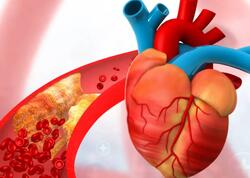 Duz, alkoloq, qəhvəni eyni vaxtda qəbul etmək olmaz - Damarlar dözməyəcək