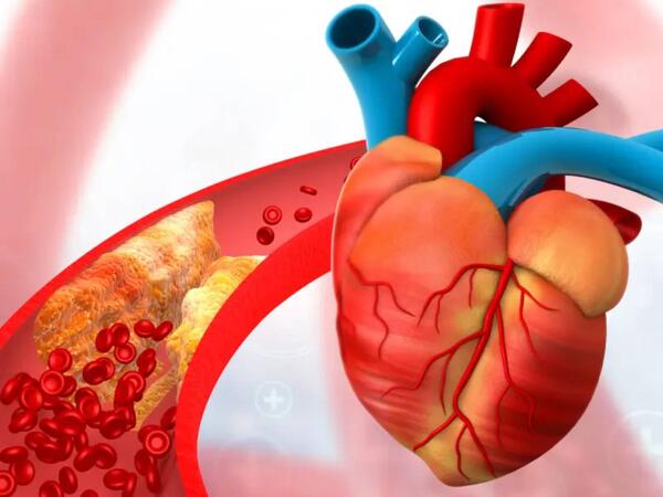 Duz, alkoloq, qəhvəni eyni vaxtda qəbul etmək olmaz - Damarlar dözməyəcək