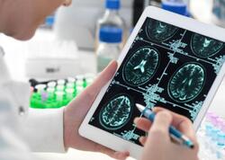 Alzheimerlə mübarizədə yeni ümid