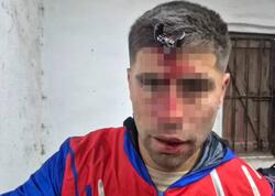 Açarla döydülər, alnında ilişib qaldı