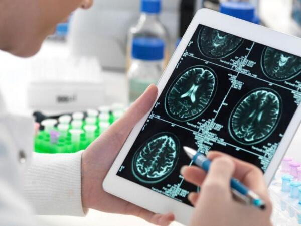 Alzheimerlə mübarizədə yeni ümid