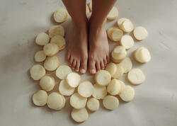 Kartof dilimini ayağın altına qoymaq soyuqdəyməni müalicə edir? - Mütəxəssisdən açıqlama