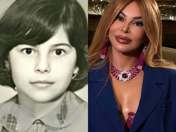 Aygün Kazımovanın illər ərzində dəyişimi - <span class="color_red">FOTO</span>