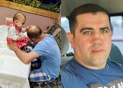 4 manata keçəllikdən ömürlük qurtuldu - FOTO