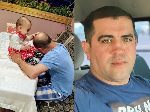 4 manata keçəllikdən ömürlük qurtuldu - FOTO