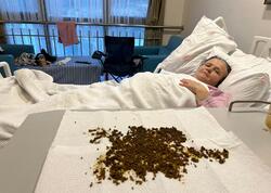 Qarın ağrısından şikayət etdi, ödündən 20 mindən çox daş çıxdı - <span class="color_red">FOTO</span>