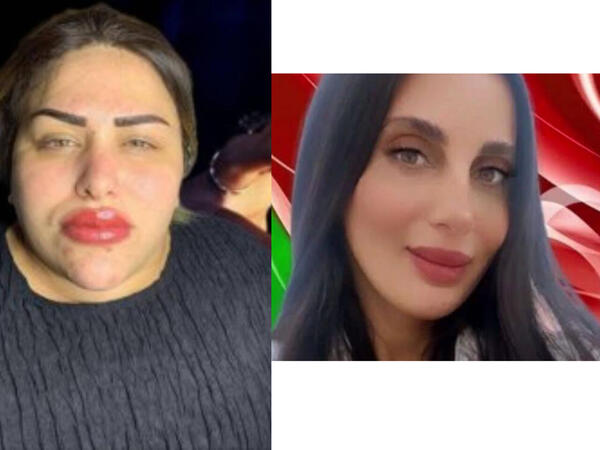 Dələduz &quot;vəkil&quot; və &quot;falçı&quot; qalmaqalı - &quot;Sevdiyi oğlanı özünə yaxınlaşdırmaq üçün məndən şamlar aldı&quot;