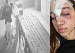 Qorxu evinə getdi - Alnına 11 tikiş qoyuldu