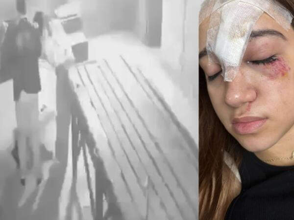 Qorxu evinə getdi - Alnına 11 tikiş qoyuldu