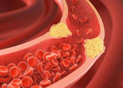 Xolestrini azaldan meyvə - Kilosu 1 manat 50 qəpikdir