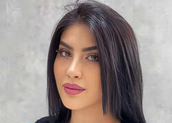 Pilinq reklamı faciəyə çevrildi: Tiktoker Ləmanın üzündə yanıq yarandı