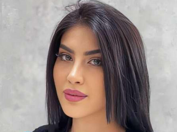 Pilinq reklamı faciəyə çevrildi: Tiktoker Ləmanın üzündə yanıq yarandı