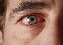 Gərginsinizsə bu vitamininiz çatışmır