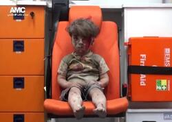 9 il əvvəl hamını məyus etmişdi - İndiki halı diqqət çəkdi - FOTO