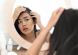 Saç tökülməsinə səbəb olan 9 mühüm faktor – <span class="color_red">xəbərdarlıq</span>