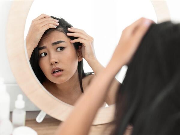 Saç tökülməsinə səbəb olan 9 mühüm faktor – <span class="color_red">xəbərdarlıq</span>