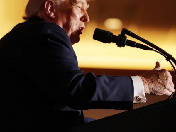 “Trampın əli çox salamlaşmaqdan göyərib” - FOTO