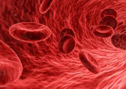 Qanda dəmiri artıran məhsullar açıqlandı