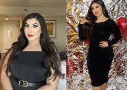 Ac qalmadan 23 kilo verdi: “Sadəcə hər yeməyin yanında bunu yeyirdim” - <span class="color_red">FOTO</span>