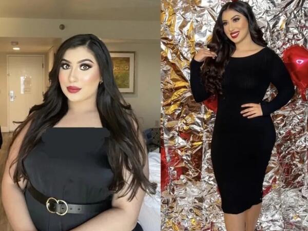 Ac qalmadan 23 kilo verdi: “Sadəcə hər yeməyin yanında bunu yeyirdim” - <span class="color_red">FOTO</span>