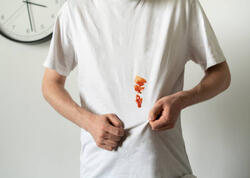 Ağ geyimlərdəki ləkələri bu üsullarla yox edin