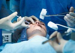 Keçirdiyi əməliyyatlarla başqa insana ÇEVRİLDİ - <span class="color_red">VİDEO</span>