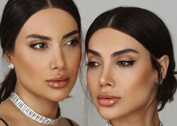 "Əcəb edirik, yenə də plastik əməliyyata gedəcəyik"