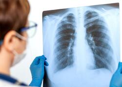 Məktəblilər arasında pnevmoniya sürətlə yayılır - XƏBƏRDARLIQ