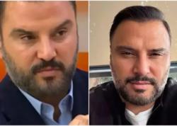 Alişan botoks etdirdiyini belə etiraf etdi - <span class="color_red">FOTO</span>