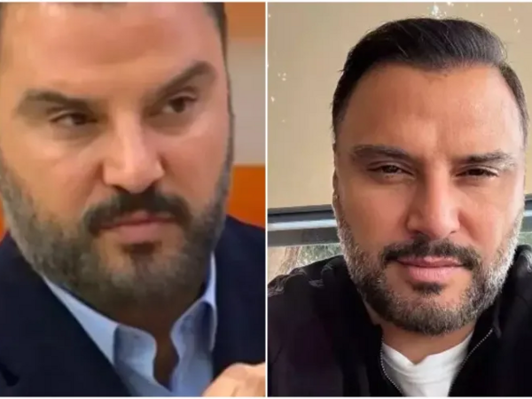 Alişan botoks etdirdiyini belə etiraf etdi - <span class="color_red">FOTO</span>