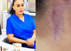 “Məni gözəllik salonunda əməliyyat etdi, ağzım əyilir” - <span class="color_red">VİDEO</span>