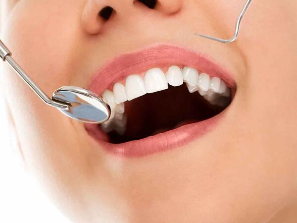 Dişlərin sayı və vəziyyəti ömür uzunluğuna təsir edir - ARAŞDIRMA