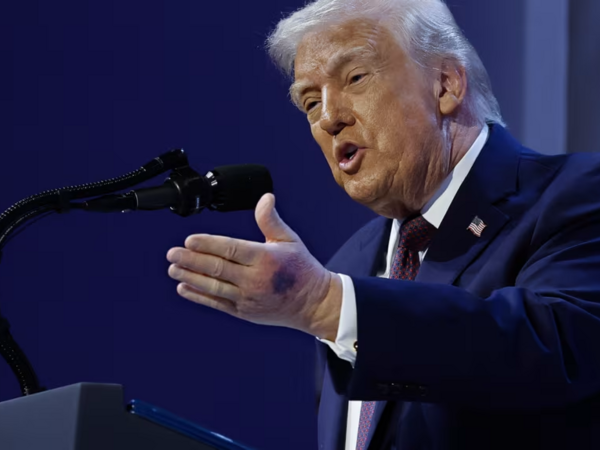 Ağ Ev Trampın əlindəki göyərmələrin səbəbini açıqladı - <span class="color_red">FOTO</span>