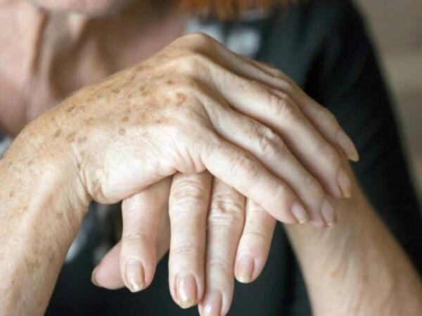 Əllərin dərisini necə cavanlaşdırmaq olar? -Yaşınızı ələ verməsin