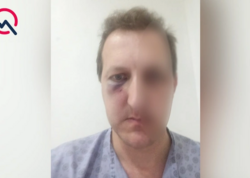 Oğlu döyülən Xalq artistinin həyat yoldaşı: "Beyni silkələnib..." - <span class="color_red">FOTO</span>