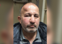 Ata və oğul "Azəriqaz"ın evə çağırdıqları əməkdaşını döyüblər? - <span class="color_red">FOTO</span>